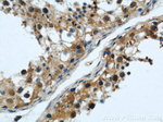 ERI1 Antibody in Immunohistochemistry (Paraffin) (IHC (P))