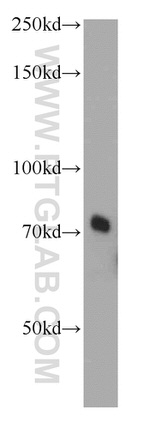 RAB11FIP5 Antibody in Western Blot (WB)