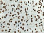 HMGB2 Antibody in Immunohistochemistry (Paraffin) (IHC (P))