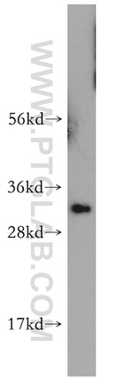 HMGB2 Antibody in Western Blot (WB)