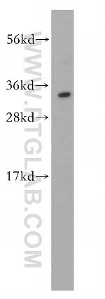 HMGB2 Antibody in Western Blot (WB)