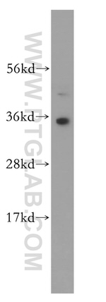 HMGB2 Antibody in Western Blot (WB)