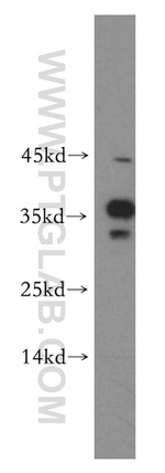 HMGB2 Antibody in Western Blot (WB)