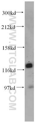 HNRNPU Antibody in Western Blot (WB)