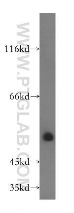 B3GALTL Antibody in Western Blot (WB)