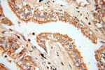 MAGEA6 Antibody in Immunohistochemistry (Paraffin) (IHC (P))