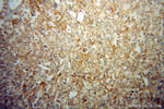 HIBCH Antibody in Immunohistochemistry (Paraffin) (IHC (P))