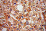 HIBCH Antibody in Immunohistochemistry (Paraffin) (IHC (P))