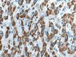 HIBCH Antibody in Immunohistochemistry (Paraffin) (IHC (P))