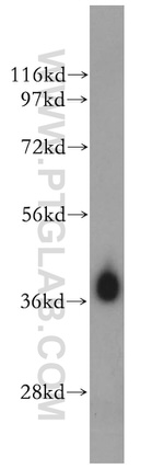 HIBCH Antibody in Western Blot (WB)