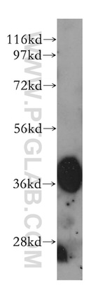 HIBCH Antibody in Western Blot (WB)