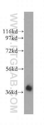 HIBCH Antibody in Western Blot (WB)