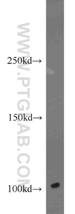 DNM2 Antibody in Western Blot (WB)