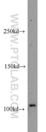 DNM2 Antibody in Western Blot (WB)