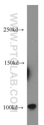 DNM2 Antibody in Western Blot (WB)