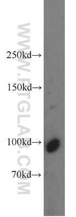 DNM2 Antibody in Western Blot (WB)