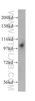 DNM2 Antibody in Western Blot (WB)