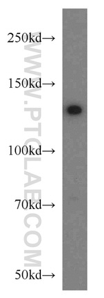 PKN2 Antibody in Western Blot (WB)