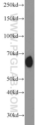 RBPJ Antibody in Western Blot (WB)