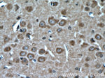 KIF17 Antibody in Immunohistochemistry (Paraffin) (IHC (P))