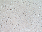 KIF17 Antibody in Immunohistochemistry (Paraffin) (IHC (P))