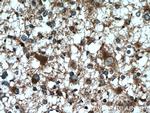KIF17 Antibody in Immunohistochemistry (Paraffin) (IHC (P))