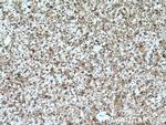KIF17 Antibody in Immunohistochemistry (Paraffin) (IHC (P))