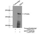 KIF17 Antibody in Immunoprecipitation (IP)
