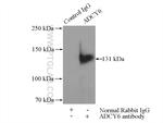 ADCY6 Antibody in Immunoprecipitation (IP)