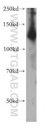 ADCY6 Antibody in Western Blot (WB)