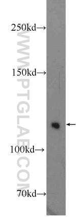 TUBGCP5 Antibody in Western Blot (WB)