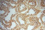 AKAP14 Antibody in Immunohistochemistry (Paraffin) (IHC (P))