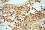 AKAP14 Antibody in Immunohistochemistry (Paraffin) (IHC (P))
