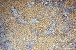 AKAP14 Antibody in Immunohistochemistry (Paraffin) (IHC (P))