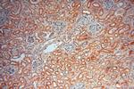 AKAP14 Antibody in Immunohistochemistry (Paraffin) (IHC (P))