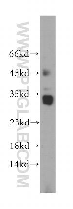 AKAP14 Antibody in Western Blot (WB)