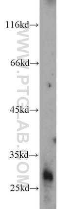 AKAP14 Antibody in Western Blot (WB)