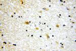 SV2B Antibody in Immunohistochemistry (Paraffin) (IHC (P))