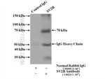 SV2B Antibody in Immunoprecipitation (IP)