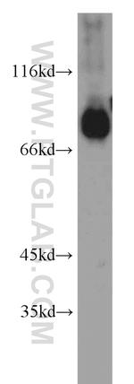 SV2B Antibody in Western Blot (WB)