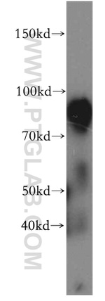 SV2B Antibody in Western Blot (WB)