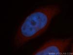 RABEP2 Antibody in Immunocytochemistry (ICC/IF)