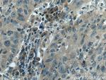 RABEP2 Antibody in Immunohistochemistry (Paraffin) (IHC (P))