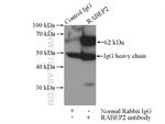 RABEP2 Antibody in Immunoprecipitation (IP)