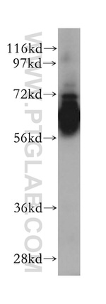 RABEP2 Antibody in Western Blot (WB)
