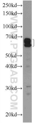 RABEP2 Antibody in Western Blot (WB)
