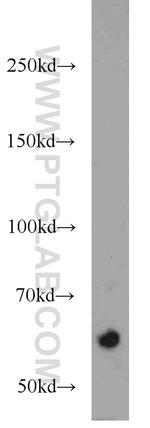 RABEP2 Antibody in Western Blot (WB)