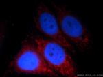 HPS4 Antibody in Immunocytochemistry (ICC/IF)