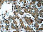 HPS4 Antibody in Immunohistochemistry (Paraffin) (IHC (P))