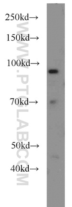 HPS4 Antibody in Western Blot (WB)